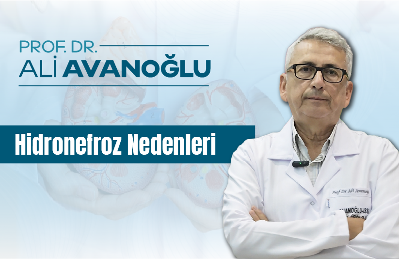 Hidronefroz nedenleri