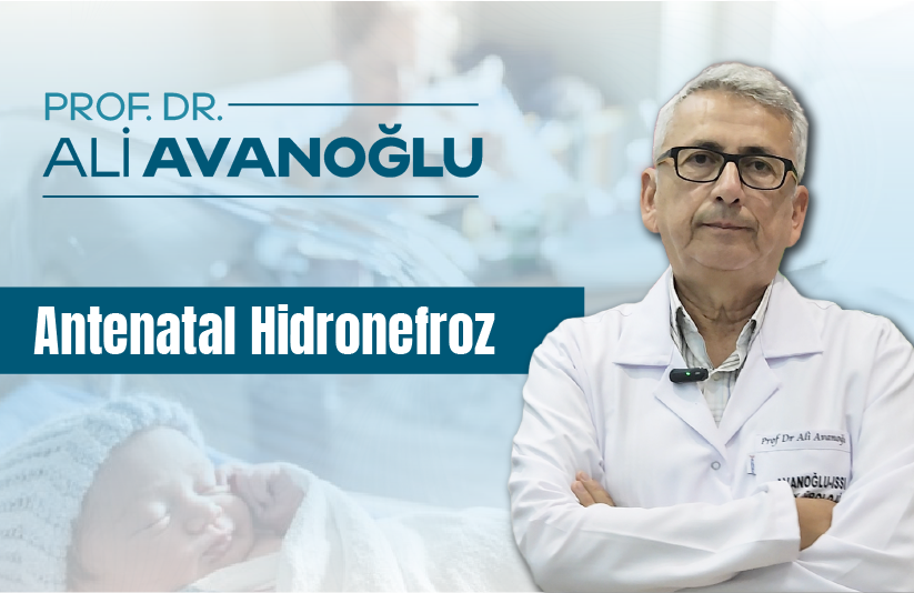 Antenatal hidronefroz