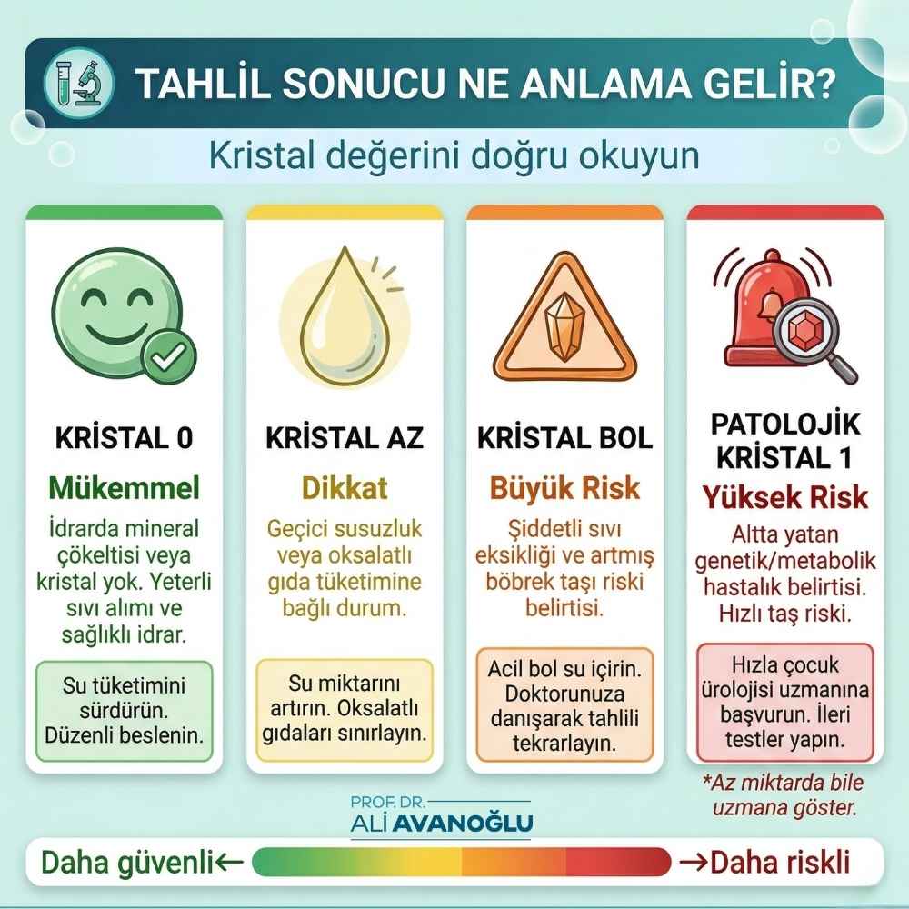 Bebeklerde idrarda kristal yüksekliği