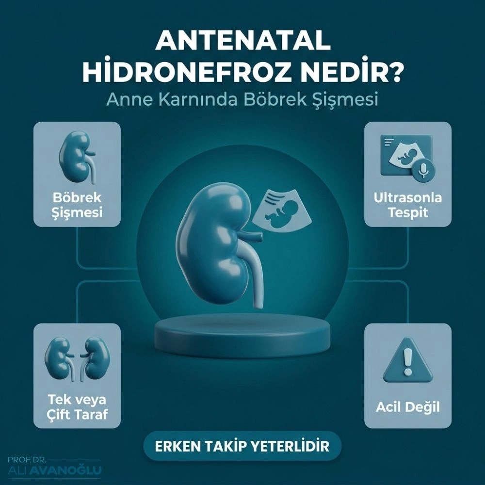 antenatal hidronefroz