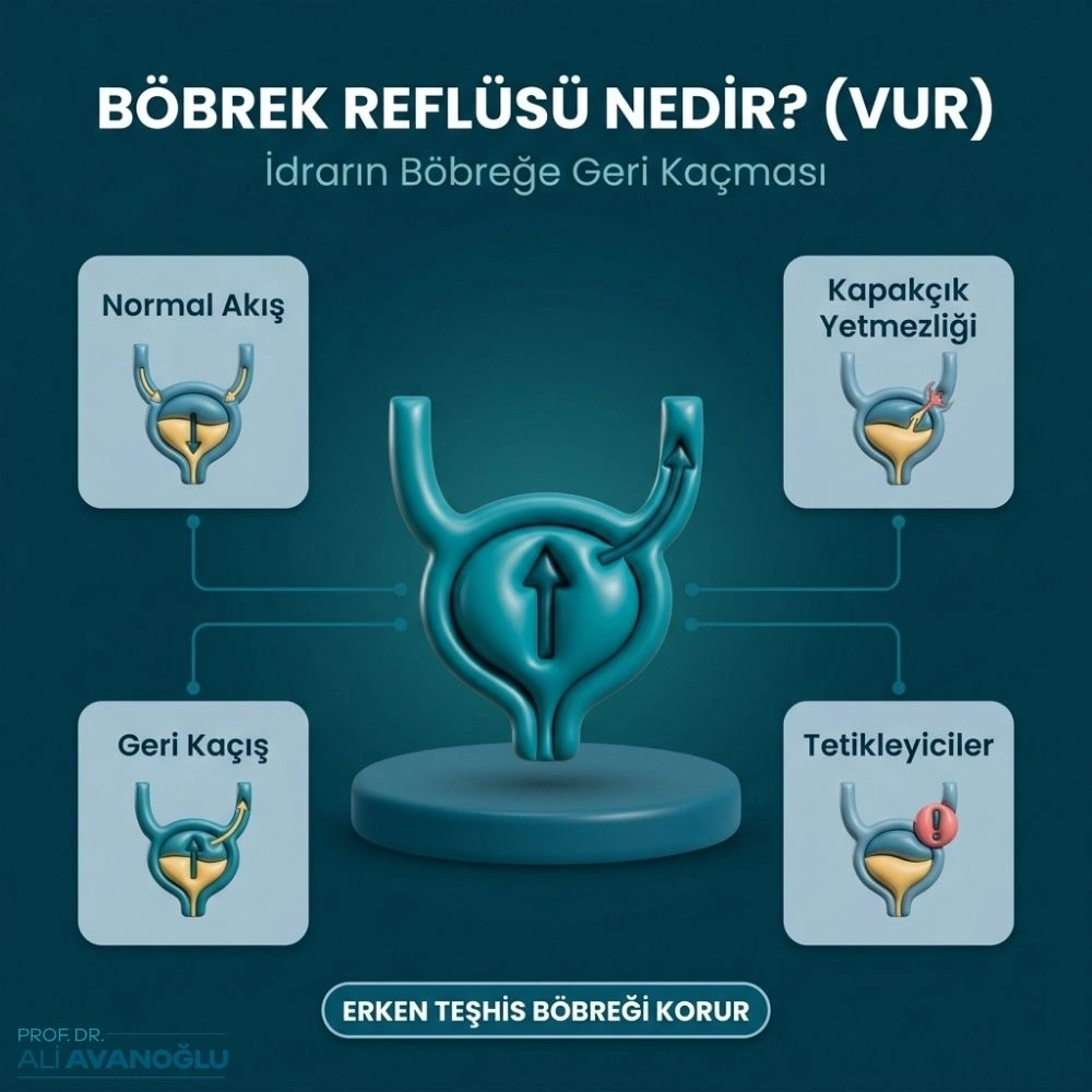 böbrek reflüsü belirtileri