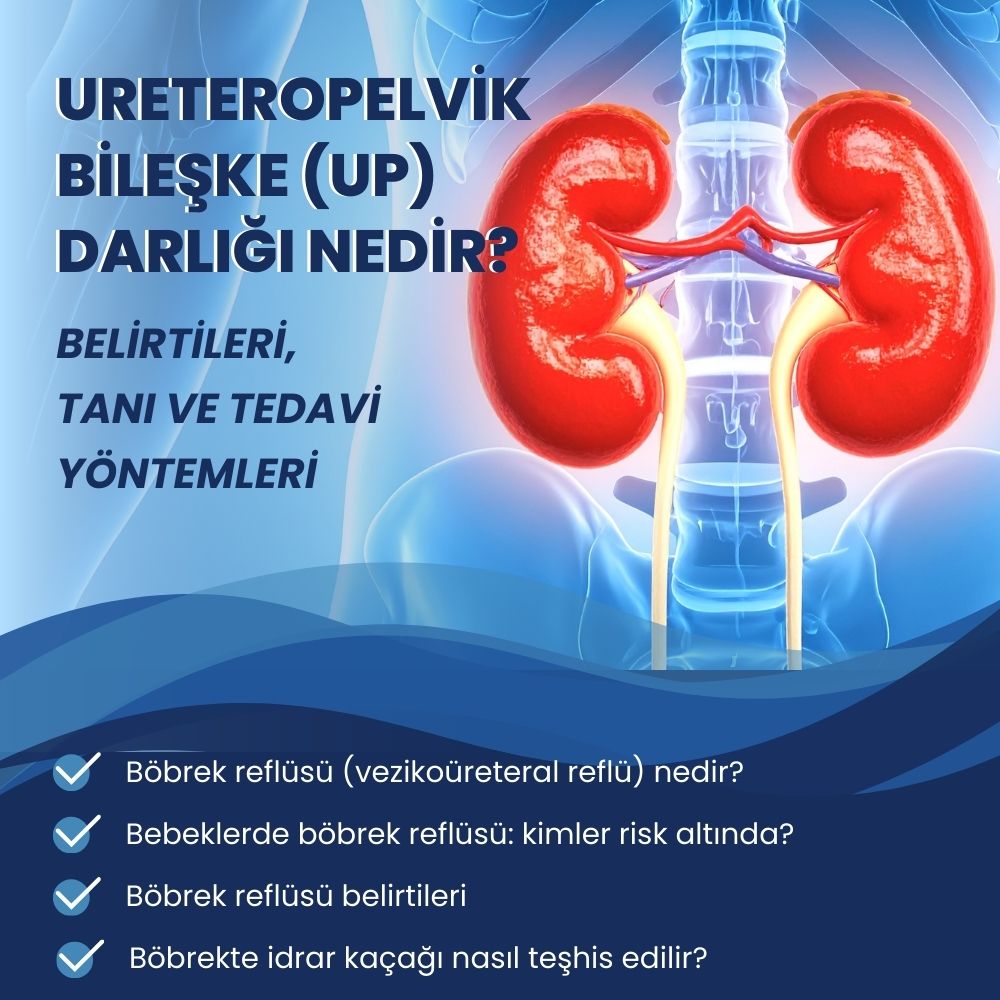 ureteropelvik-bileske-darligi-nedir